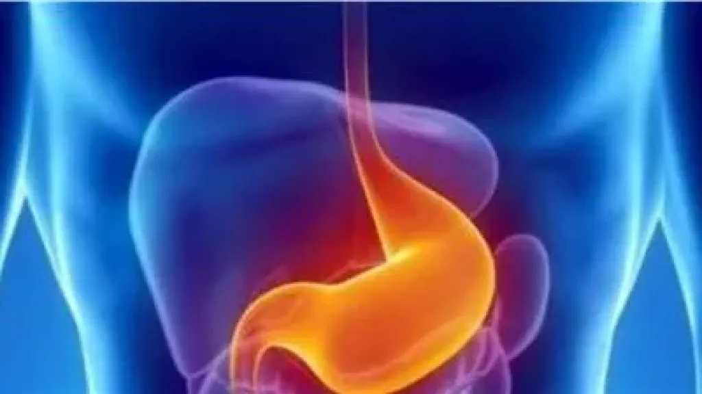 5 علامات مبكرة تكشف عن سرطان المعدة .. تحذر الأطباء