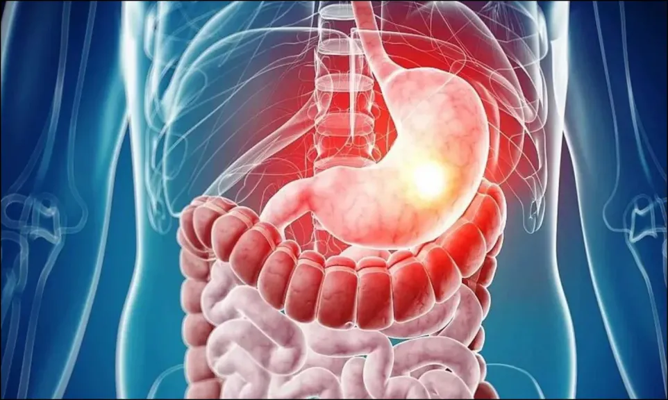طبيب جهاز هضمي يحذر: 4 أسباب رئيسية وراء التهابات المعدة تعرف عليها